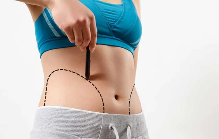 woman shows dotted line her body liposuction zone 159057 64 انواع روش های پیکرتراشی